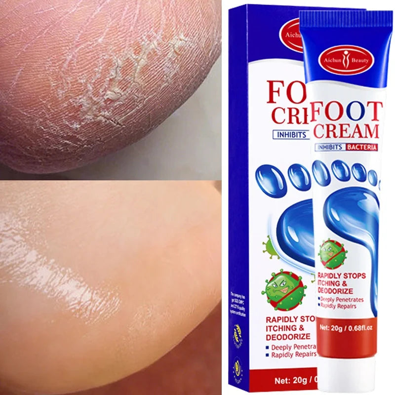 "Electrochic™ Foot Care Cream – Anti Fungus, Dead Skin Remover & Moisturizer In Pakistan."