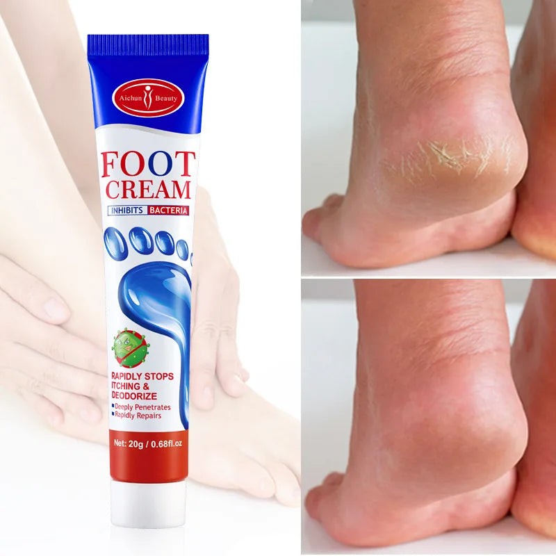 "Electrochic™ Foot Care Cream – Anti Fungus, Dead Skin Remover & Moisturizer In Pakistan."